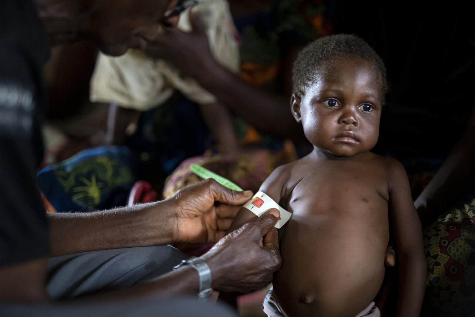 Malnutrition aiguë au Sahel et en Afrique de l’ouest : 16,7 millions d’enfants de moins de cinq ans affectés